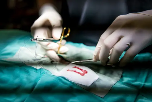 two gloved hands with scissors stitch up a surgery patient